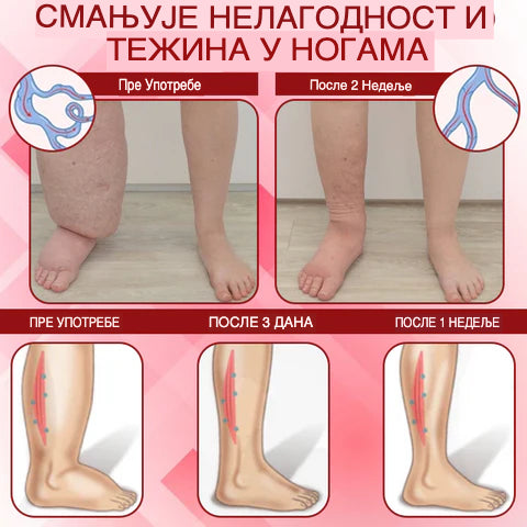 EdemaCare krema