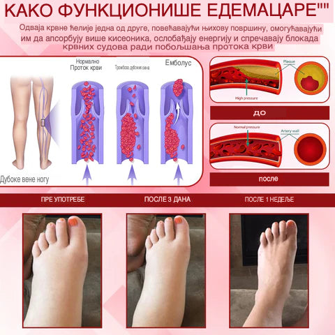 EdemaCare krema