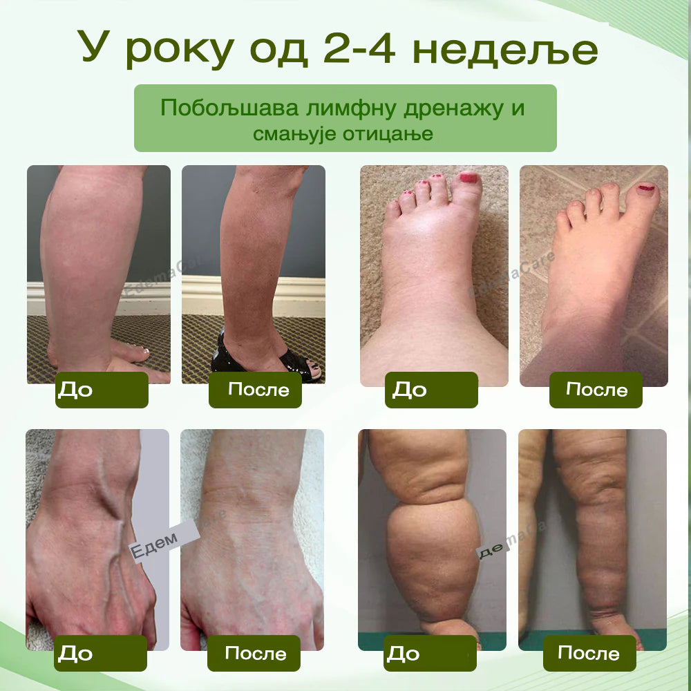 EdemaCare™ DetoxBreathe – Inhalator za detoksikaciju i zdravlje! 🌿